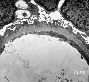 sem image analysis Renal Pathology Section