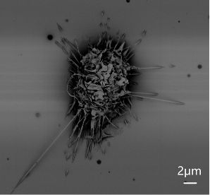 sem image analysis Macrophages