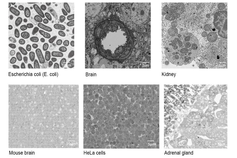CIQTEK Volumetric Electron Microscopy (VEM) Solution